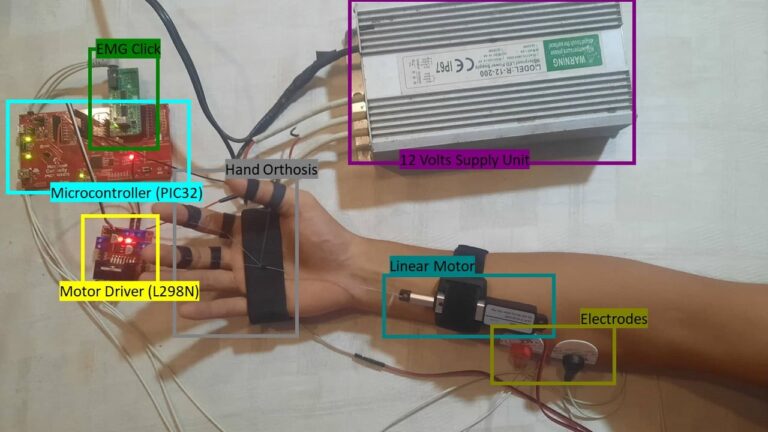 Researchers achieve an 86% response accuracy rate for a hand orthosis for stroke rehabilitation, using surface electromyography signals